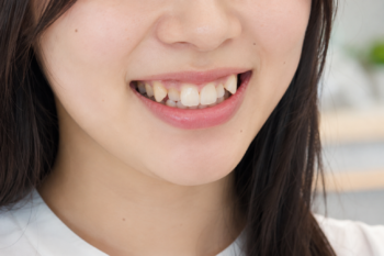 八重歯がある女性