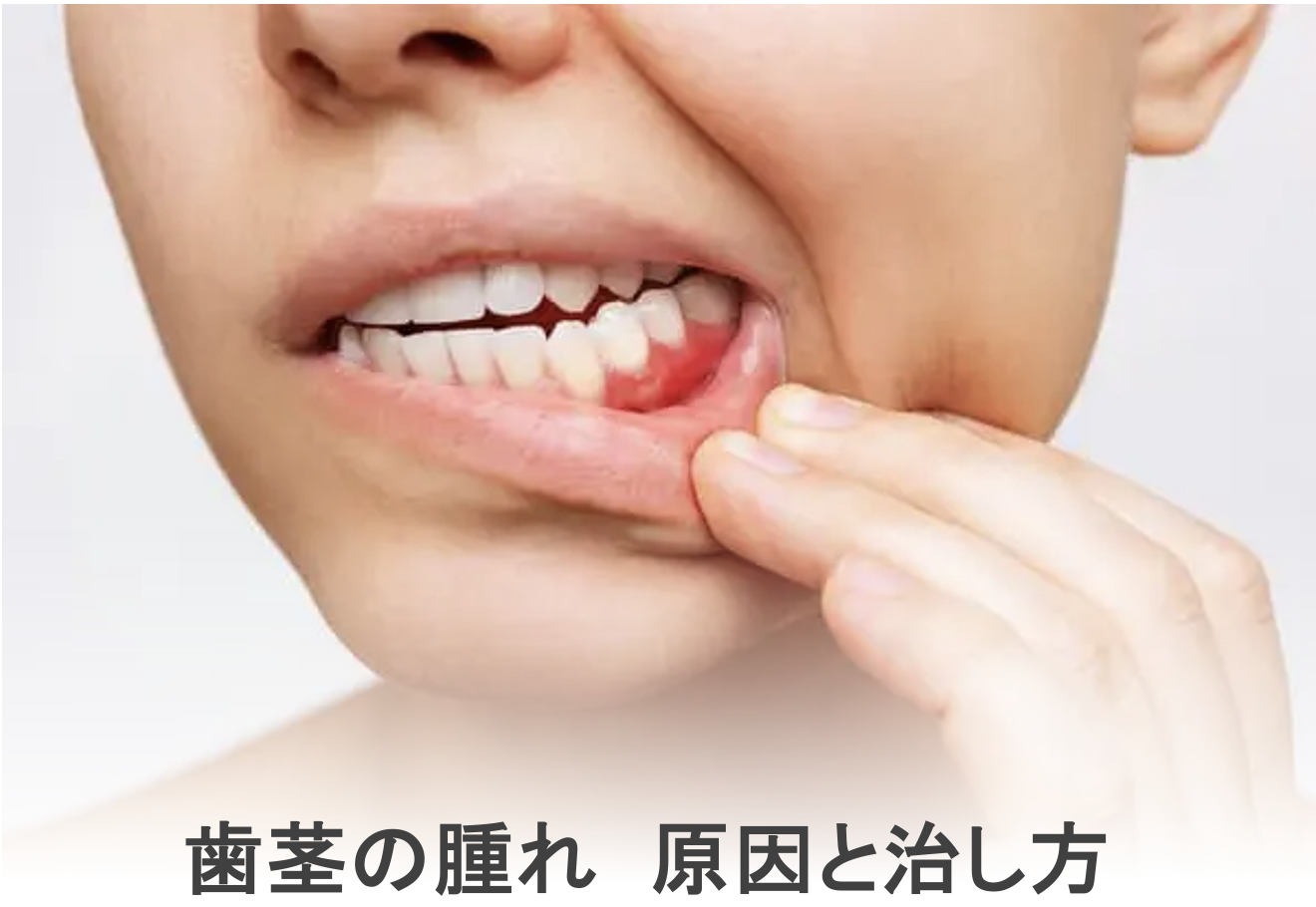 口内炎の原因