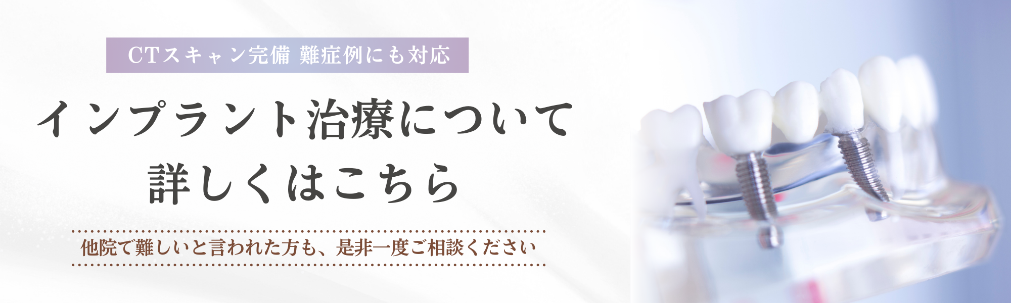 インプラント治療