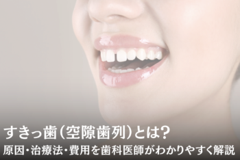 すきっ歯(空隙歯列)とは?原因・治療法・費用を歯科医師がわかりやすく解説