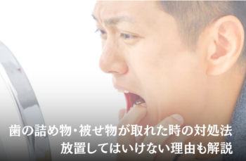歯の詰め物・被せ物が取れた時の対処法