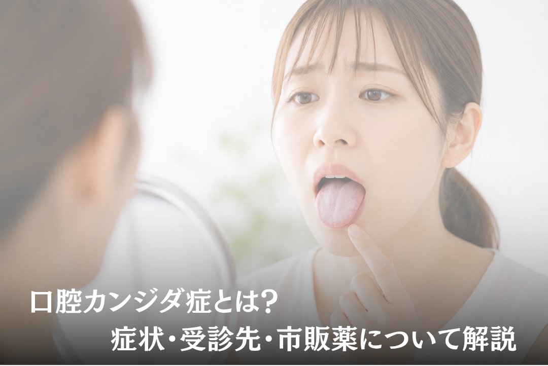 口腔カンジダ症とは?症状・受診先・市販薬について解説