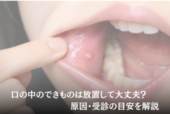 口の中のできものは放置して大丈夫?原因・受診の目安を解説