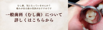 一般歯科(むし歯)ページバナー